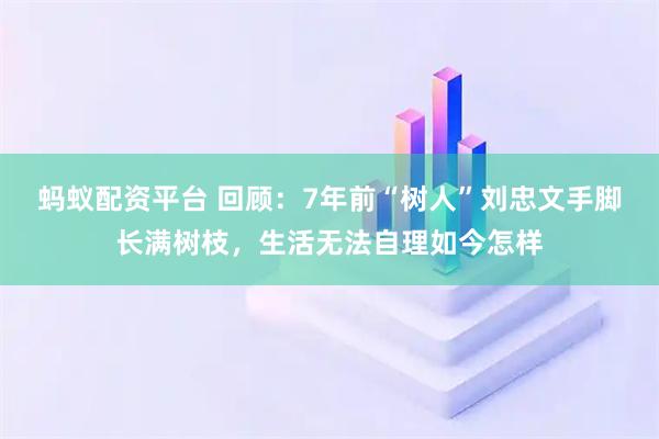 蚂蚁配资平台 回顾：7年前“树人”刘忠文手脚长满树枝，生活无法自理如今怎样